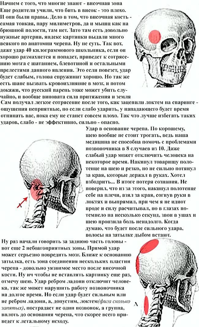 Самое слабое место в черепе. Чем можно ударить человека. Болевые точки на голове человека. Как можно омить человека?. Что будет если ударить в висок