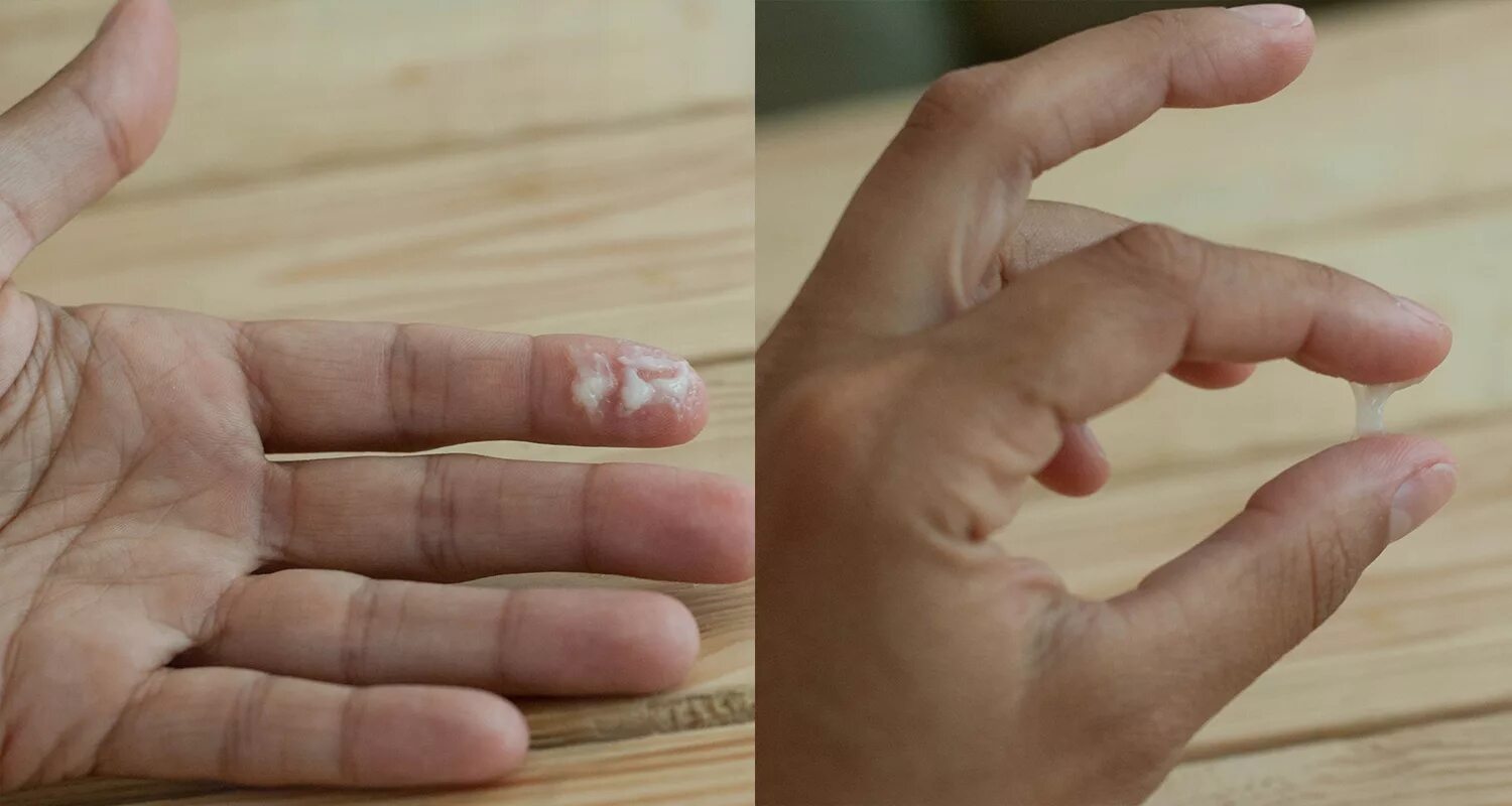 выделения густые белые без запаха у женщин. фертильная цервикальная слизь. выделения густые белые без запаха у женщин. слизькообразные выделения. выделения из влагалища (бели).