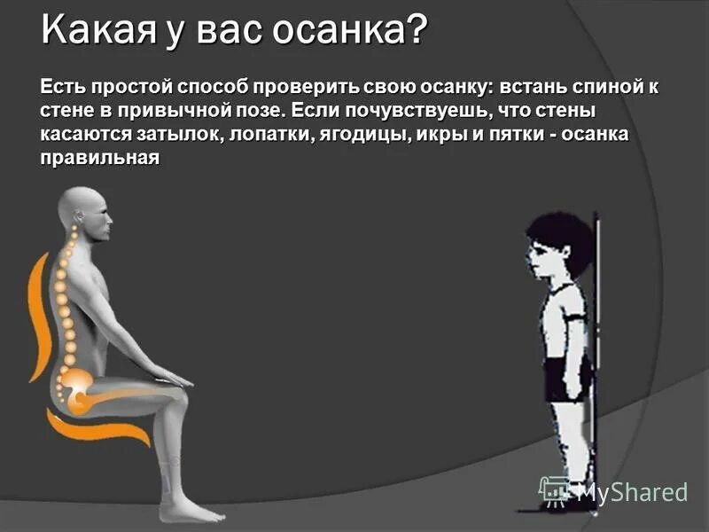 Упражнения от лордоза поясничного. Упражнения для прямой осанки. Какая может быть осанка. Упражнения для правильной осанки школьника. Человек с правильной осанкой сбоку.