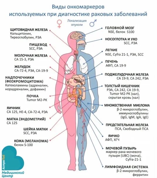 Онкомаркеры. Онкомаркеры человека. Онкомаркер поджелудочной железы. Рак са