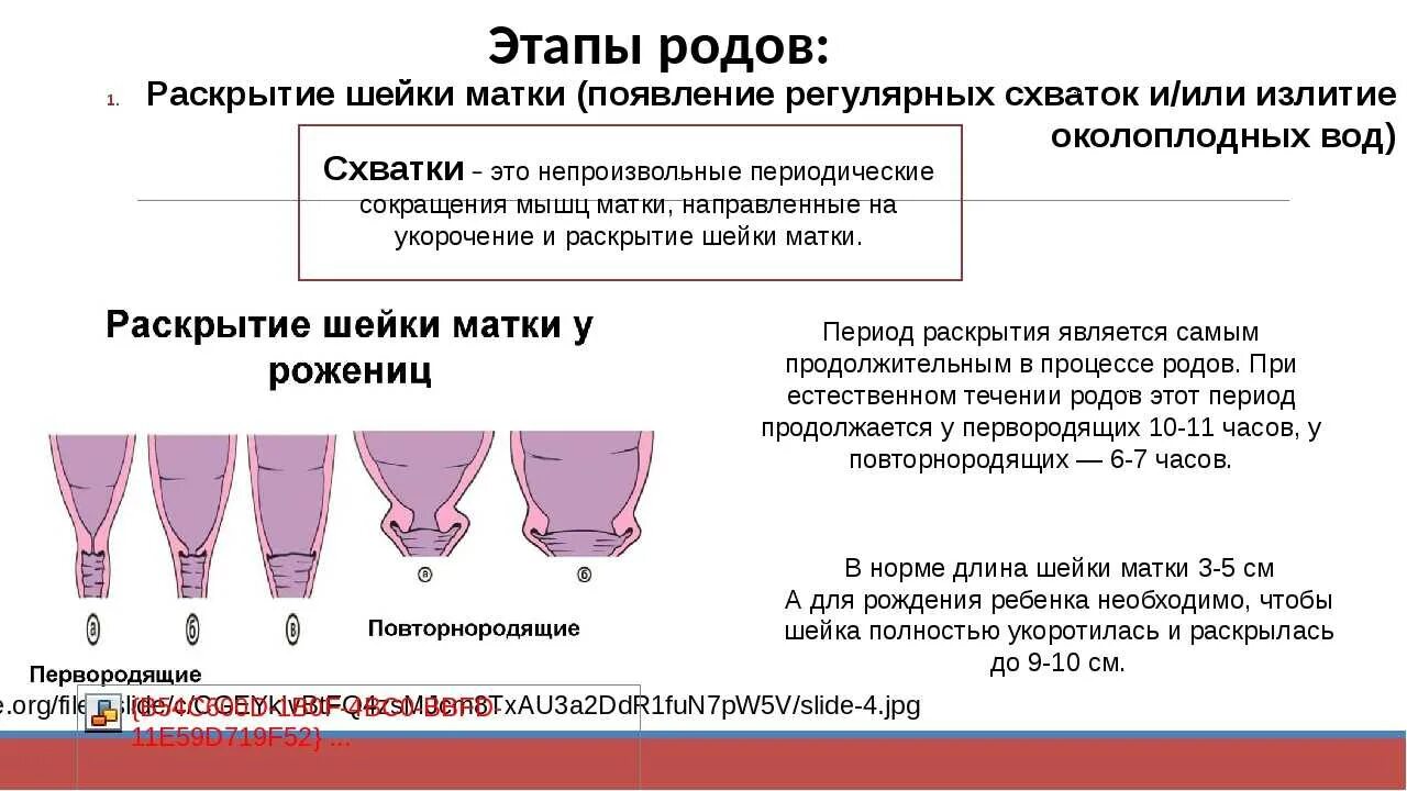 Причины схваток. Раскрытие шейки. Этапы раскрытия шейки матки. Раскрытие шейки матки при родах.