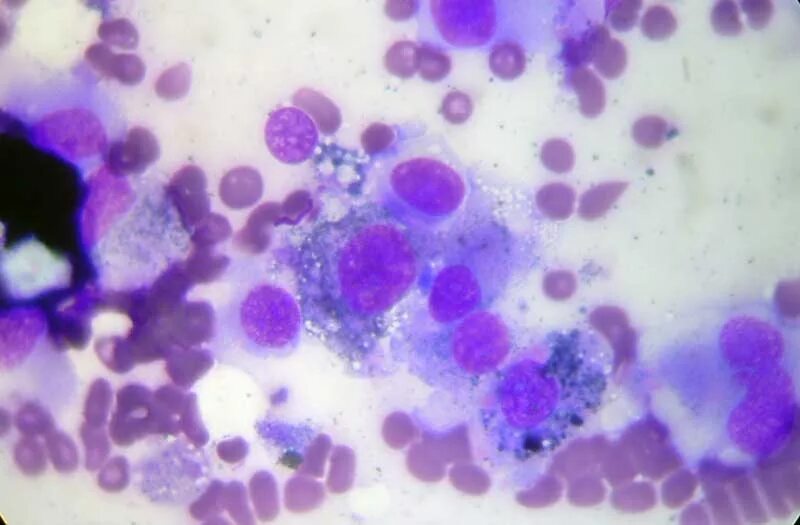 Мазки отпечатки цитология. Цитологическое исследование отпечатков. Цитологическое исследование пунктата костного мозга. Гиперкератоз мазок на цитологию. Гистологические стекла.