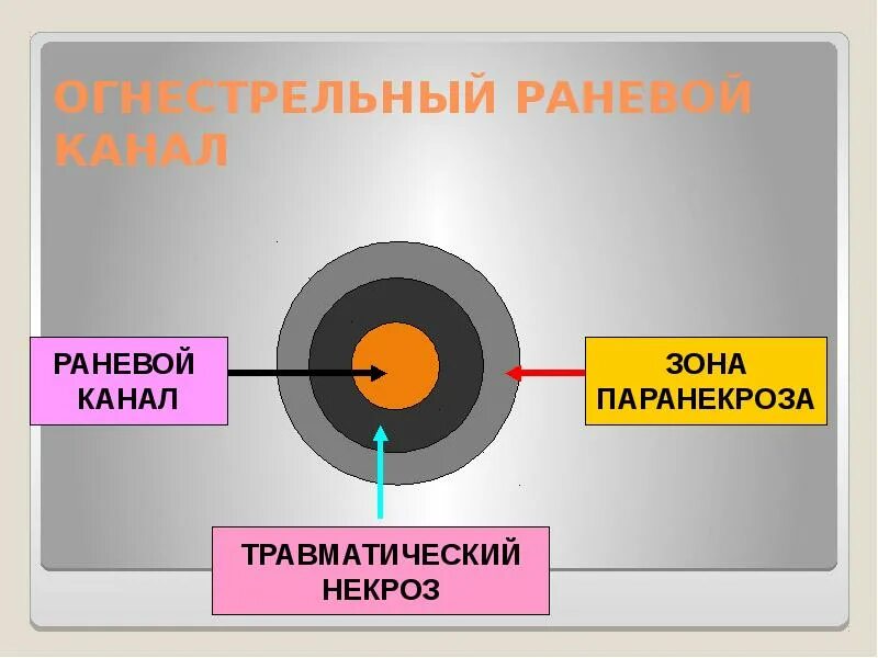Пулевой канал. Зоны огнестрельной раны. схема раневого канала и зоны. схема огнестрельной раны. схема раневого канала схема.