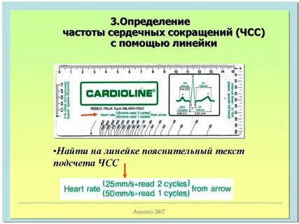 Подсчет частоты сердечных сокращений метод