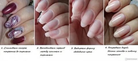 Укрепление акригелем