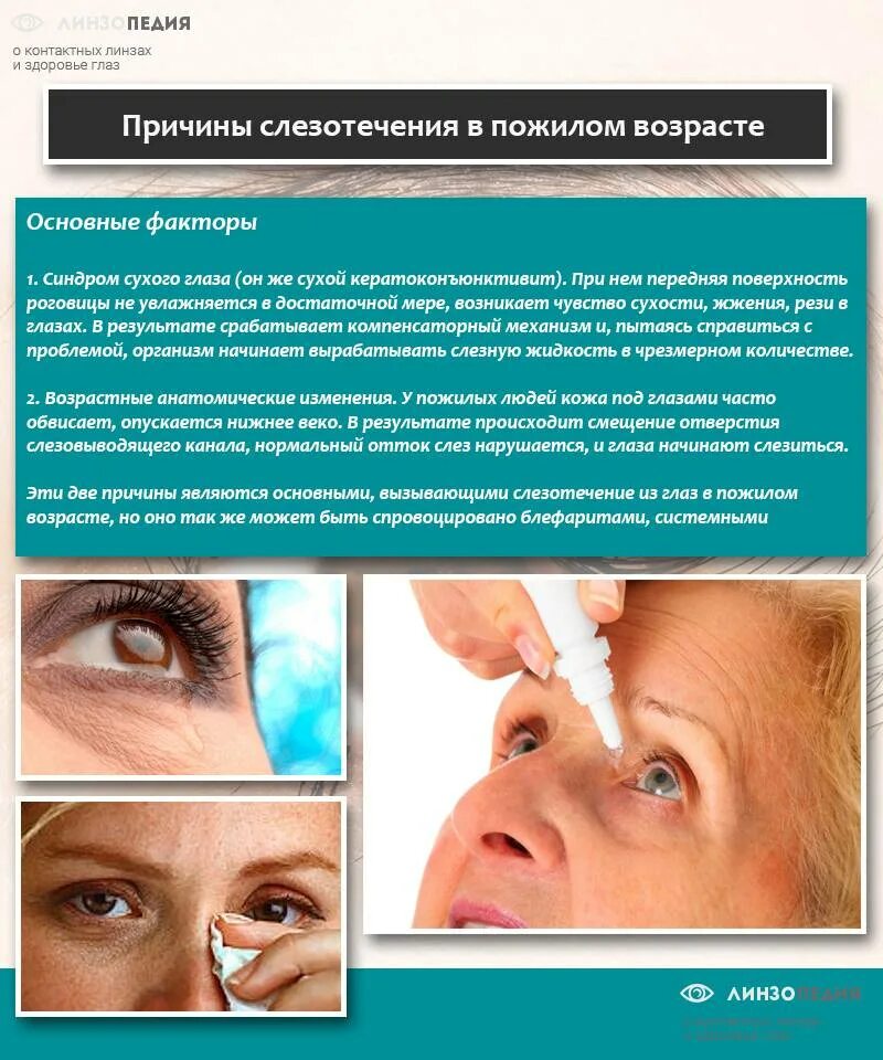 Причины слезотечения глаза. Лечение слезотечения глаз у взрослых