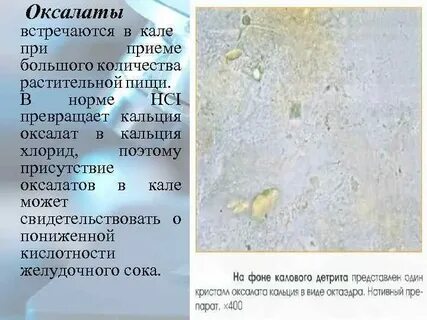 Кристаллы трипельфосфатов в кале у взрослого