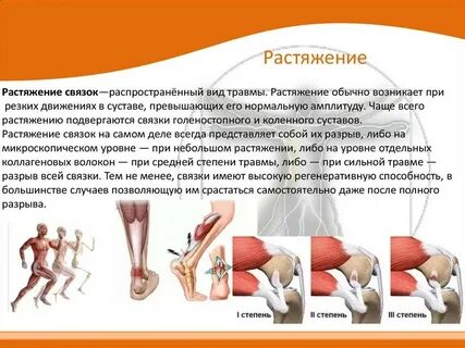 Восстановление сустава после растяжения