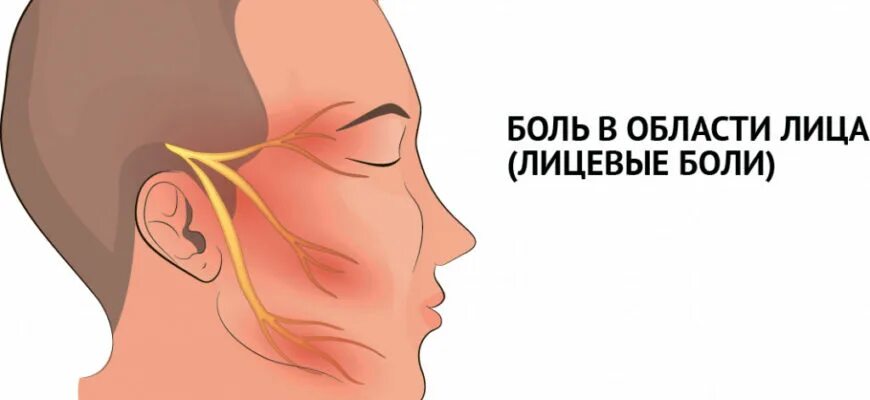 Воспаление тройничного нерва. Невралгия тройничного нерва. Отек щеки при воспалении тройничного нерва. Воспаление тройничного нерва симптомы. Воспаление нерва можно ли греть