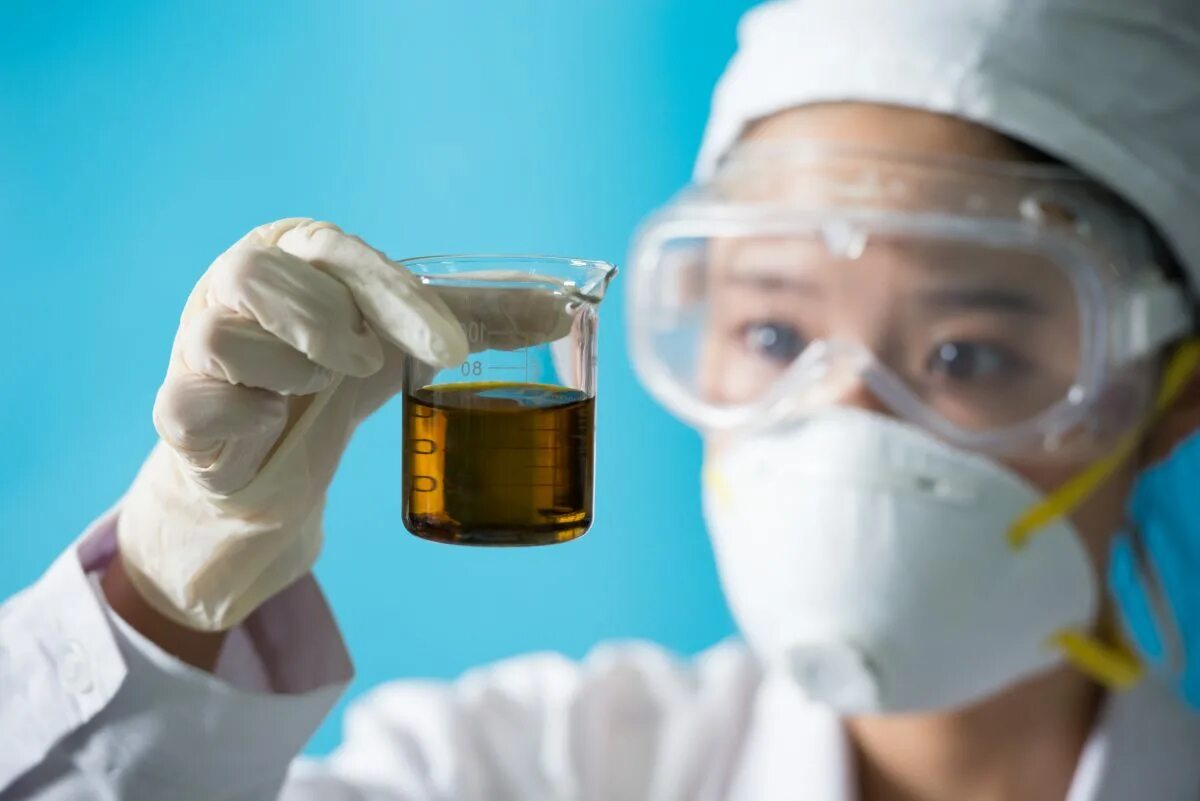 Какого цвета моча при циррозе. Dark urine. бурая моча. пенистая темная моча при желтухе.