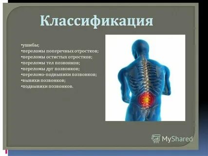 Переломы и вывихи позвоночника