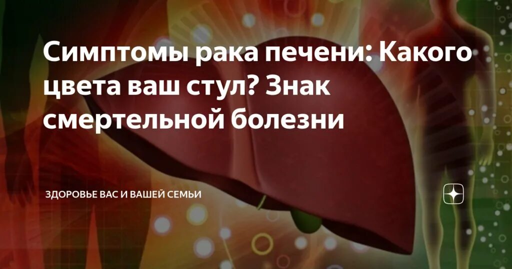 Рак печени - симптомы, виды, лечение, диагностика в ФНКЦ ФМБА России