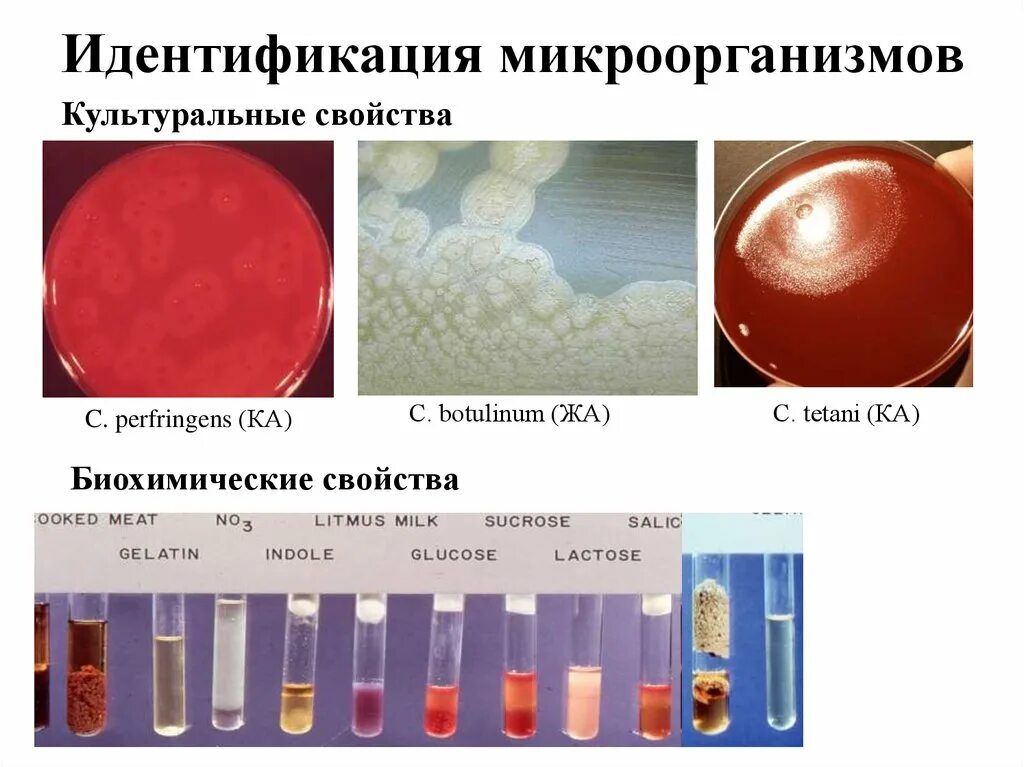 Качество пестр. Идентификация бактерий по биохимической активности. Идентификация чистых культур бактерий микробиология. Методы идентификации микроорганизмов. Идентификация выделенных микроорганизмов.