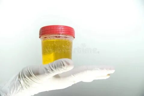 Моча разъедает кожу