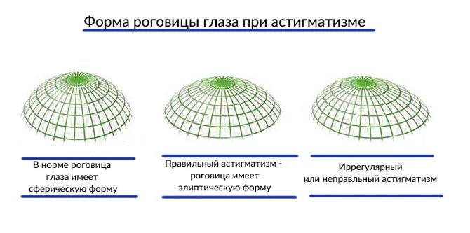 Астигматизм - САГА-ОПТИКА