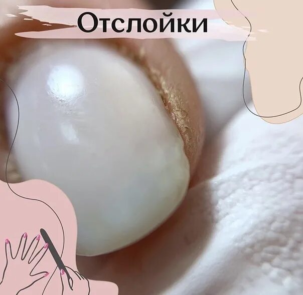 Почему появляются отслойки. Отслойки от кутикулы гель.