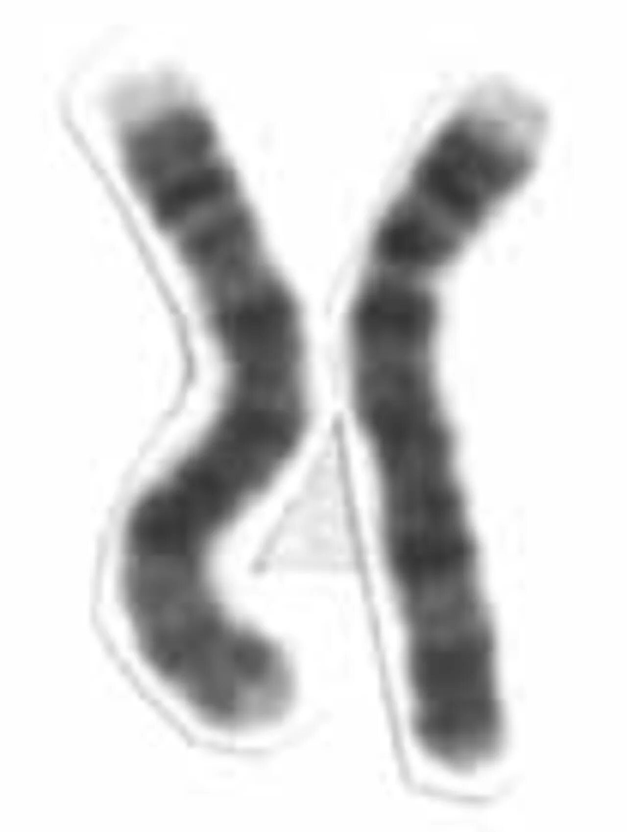 4 хромосома заболевание. 4 Хромосома. 12 Хромосома человека. 2-Я хромосома человека.