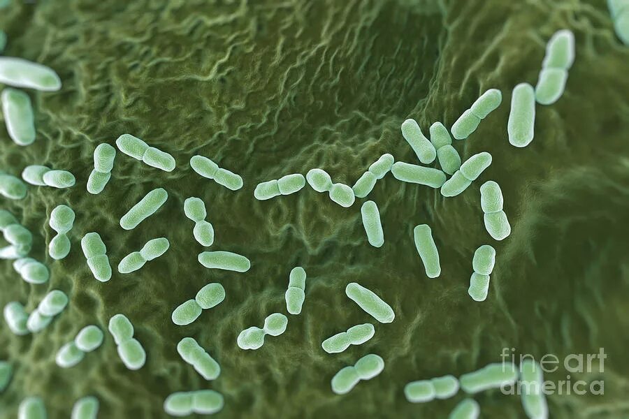 Listeria rj. Listeria monocytogenes (листерии). listeria monocytogenes микроскопия. листерии по левадити. листериоз кишечная палочка.