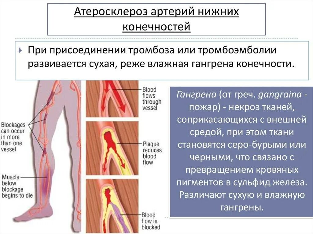 Симптомы образования тромба