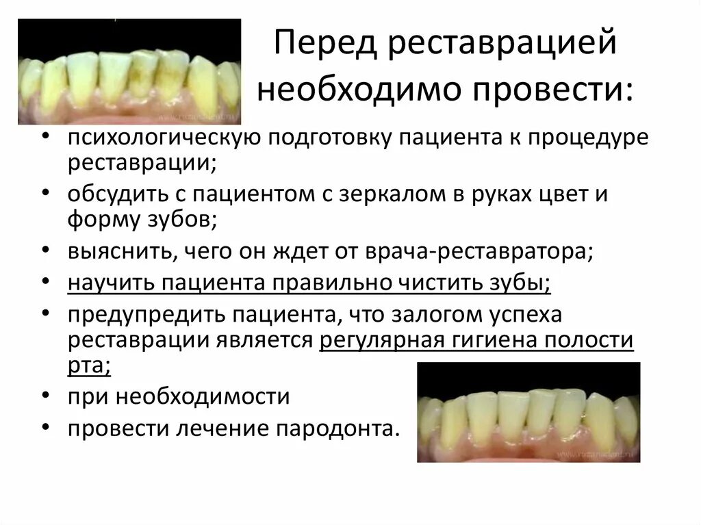 Типы реставраций. Принципы реставрации зубов. Сохранение зубов презентация. Реставрация передней группы зубов. Материалы. Реставрация зубов схема.