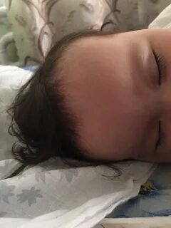 Лоб у новорожденных