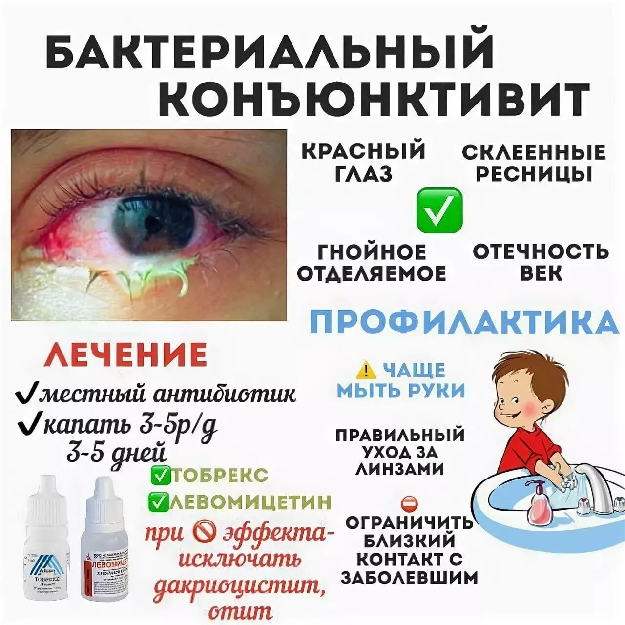 Коньюктивит чем промыть