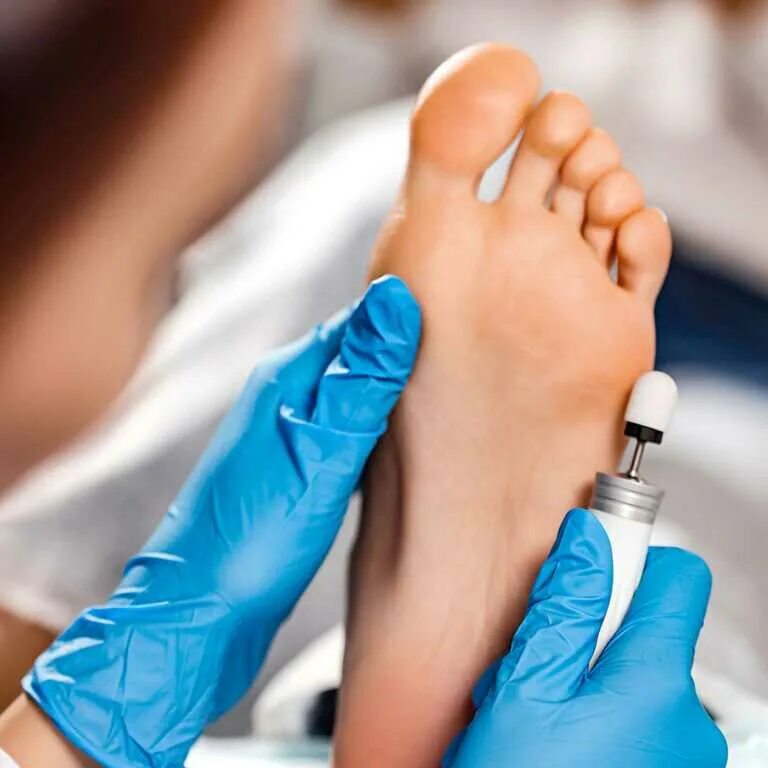 Подолог юао. Подологический педикюр. Медицинский аппаратный педикюр. Мастер педикюра подолог. Подолог с яркими волосами.