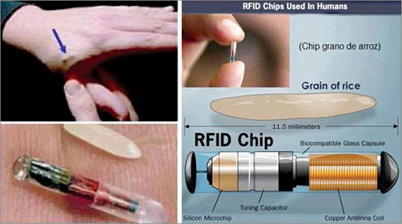 Плохо чип. Rfid чип. чип радиочастотной идентификации для людей.