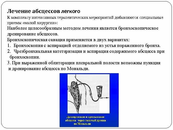 Дренаж при абсцессе