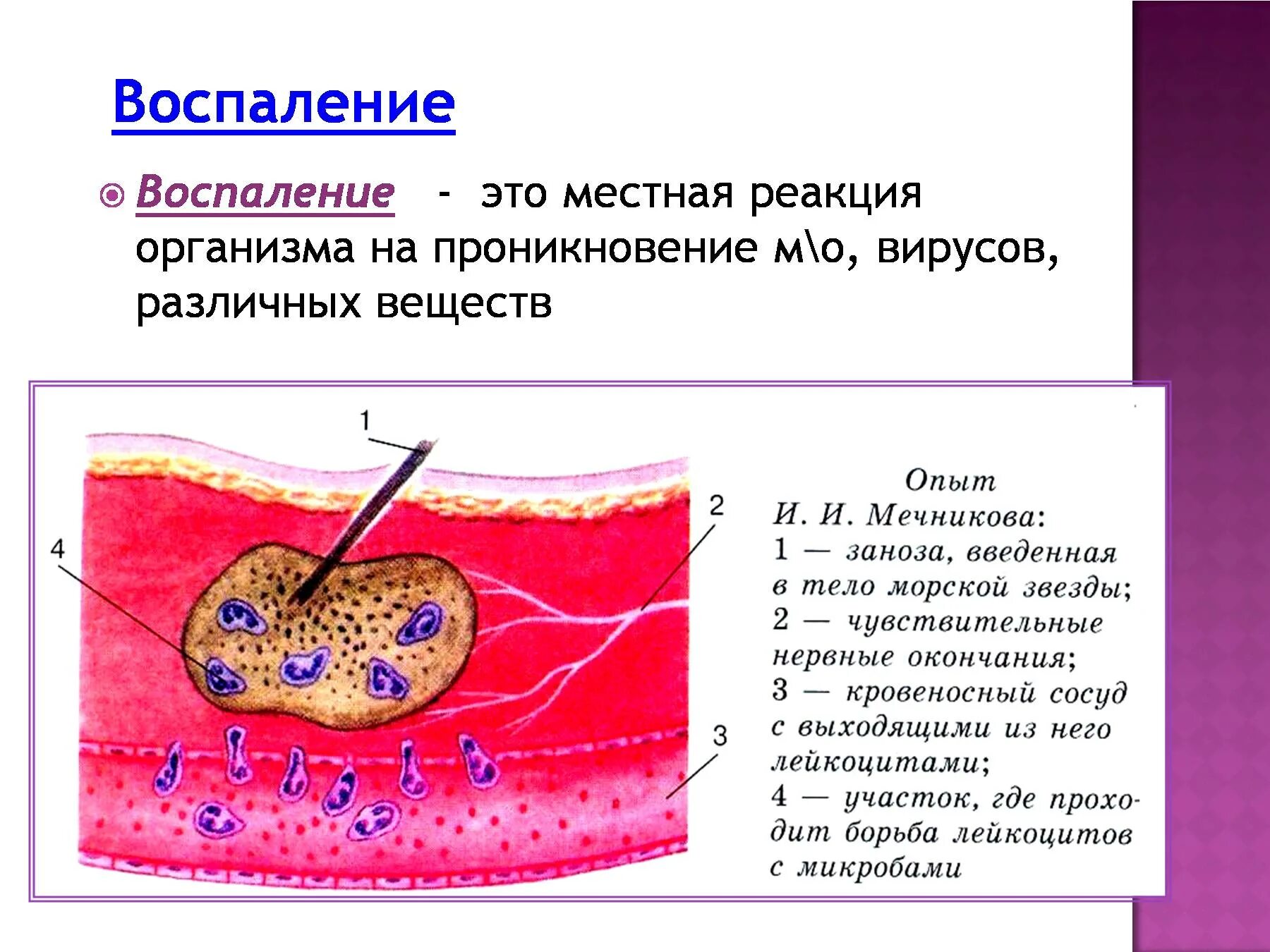 Чем грозит воспаление. Воспалительный процесс. Признаки воспалительного процесса. Местные воспалительные процессы.