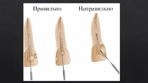 Неправильный канал