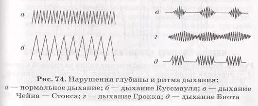 Частота нарушения сцепления