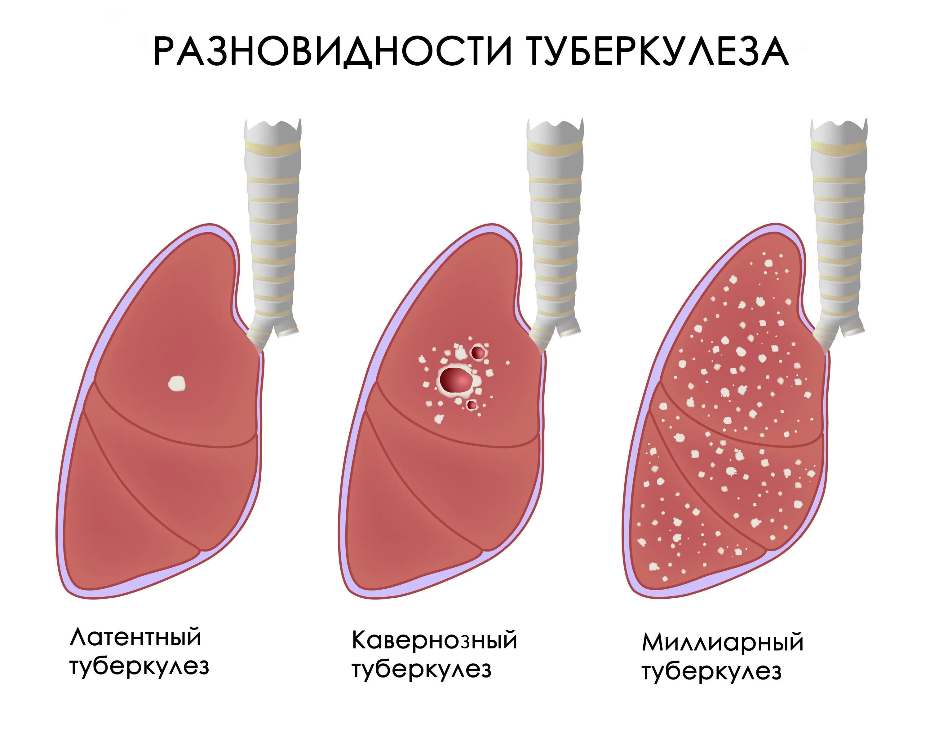 Тубик