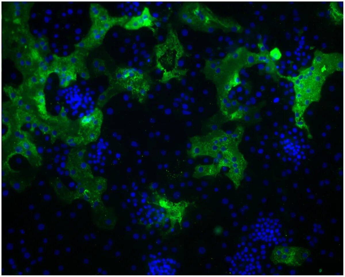 Коронавирус искусственный. Коронавирус hku1. Клетка коронавируса. Коронавирус текстура зеленая. Ядро клетки под микроскопом.