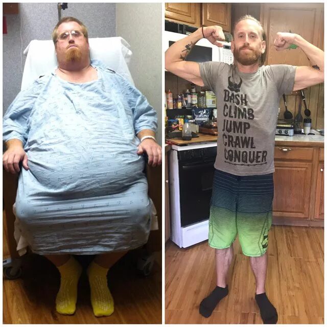 Человек весит 35 кг. До и после похудения мужчины. Мужское похудение до и после.