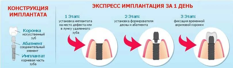 Через какое время после установки
