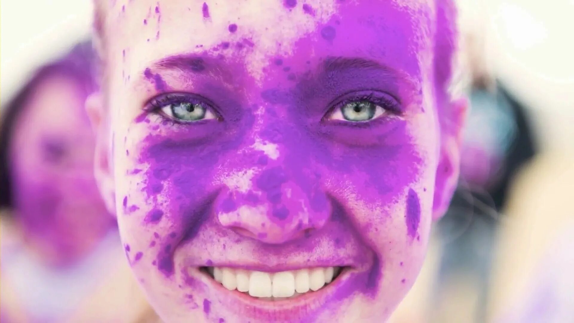 кольцевидная пурпура майокки. фиолетовый болезнь. фиолетовый болезнь. синдром вейля маркезани. синдром александрии.