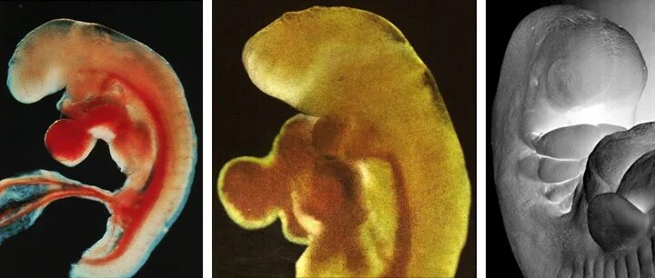 Патология жабер у человека. Жабры у человеческого зародыша. Жабры у человеческого эмбриона. Зародыш человека с жабрами.
