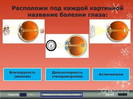 Ответы на тесты миопия