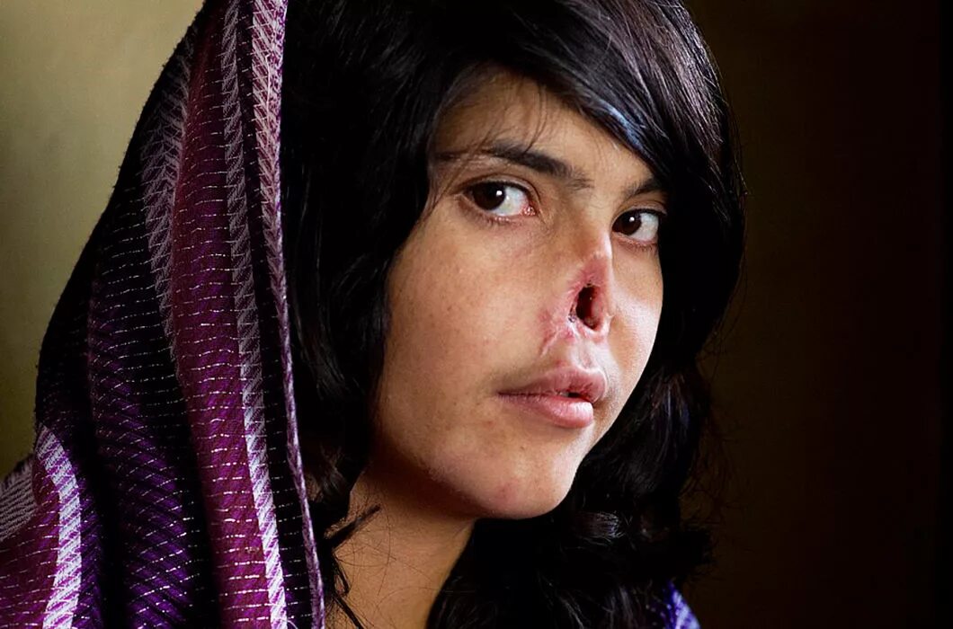 Айша Биби Афганская девушка. Биби Аиша девушка из Афганистана. Афганская девушка би би Аиша. Сколько лет было аише