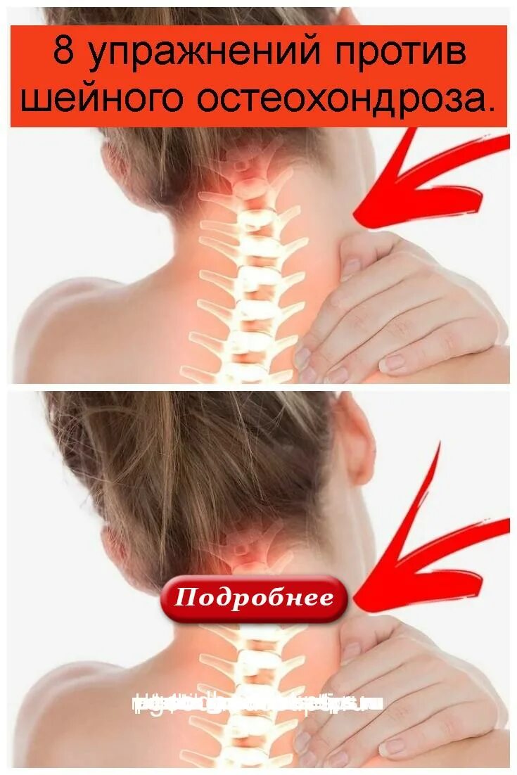 Шейный. Остеохондроз. Остеохондроз шейного отдела. При остеохондрозе шейного отдела. Головокружение при остеохондрозе отзывы