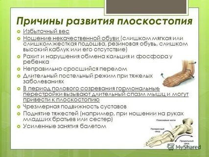 Причины плоскостопия и методы лечения москва