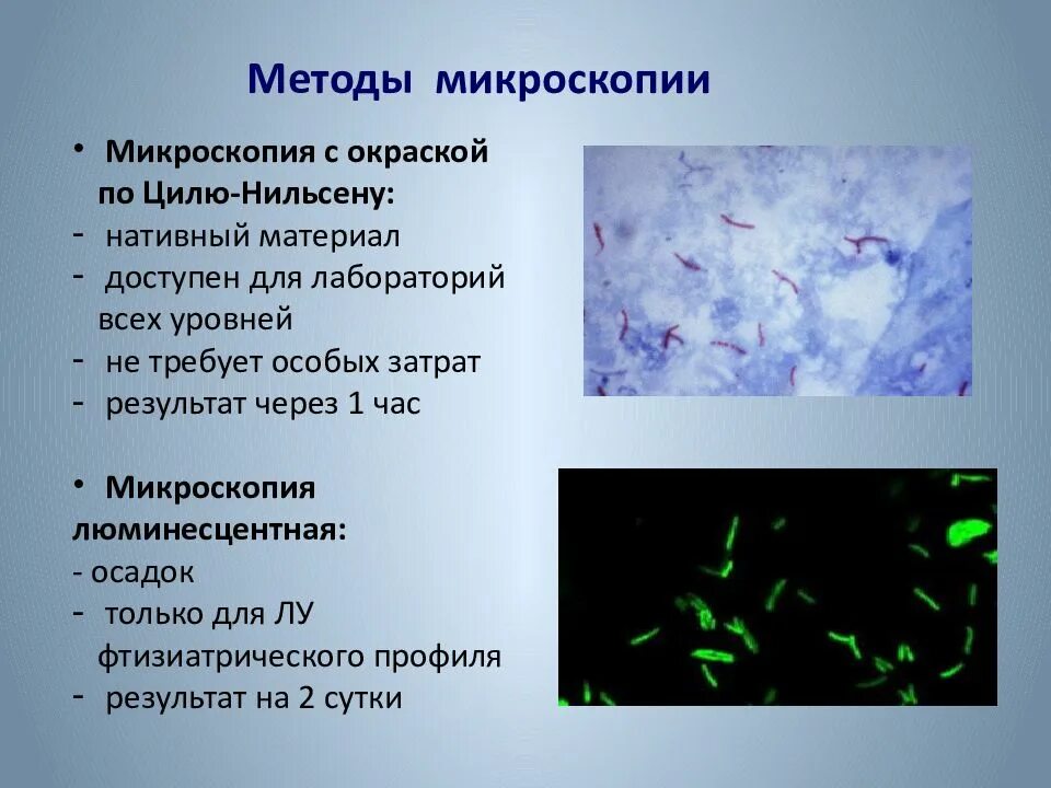 Микроскопия метод применение. Метод микроскопии по цилю-нильсену это. люминесцентная микроскопия мбт. окрашивание по цилю-нильсену. микроскопия по цилю нильсену туберкулез.