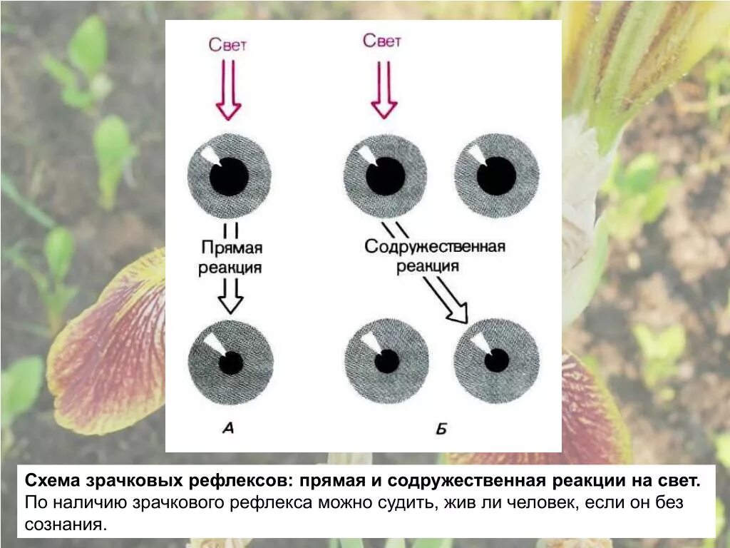 Резкая реакция на свет. Содружественная зрачковая реакция. Методы исследования зрачковых реакций. Реакция на свет прямая и содружественная. Содружественная реакция зрачков на свет.