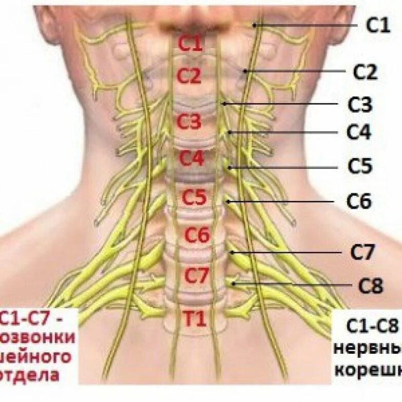 Корешки с5 с6 нервные. Остеохондроз шейного отдела с4-с5 с-с6 с7. Межпозвонковые диски c5 c6 c7. Шейный остеохондроз с4-с6. Остеохондроз с7