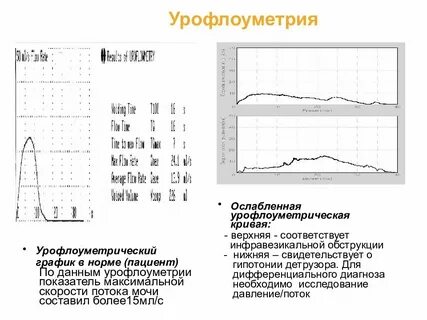 Скорость мочеиспускания