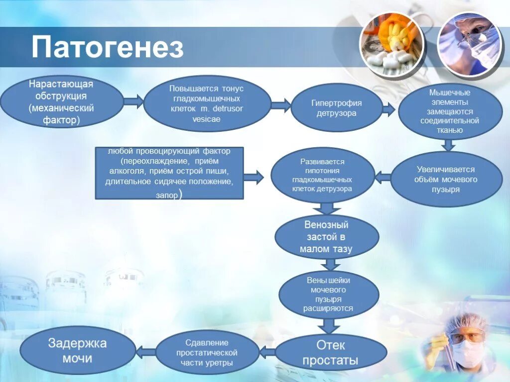 Задержка мочи у мужчин лечение. Острая задержка мочеиспускания патогенез. Механизм развития острой задержки мочеиспускания. Острая задержка мочи патогенез. Острая задержка мочи этиология.