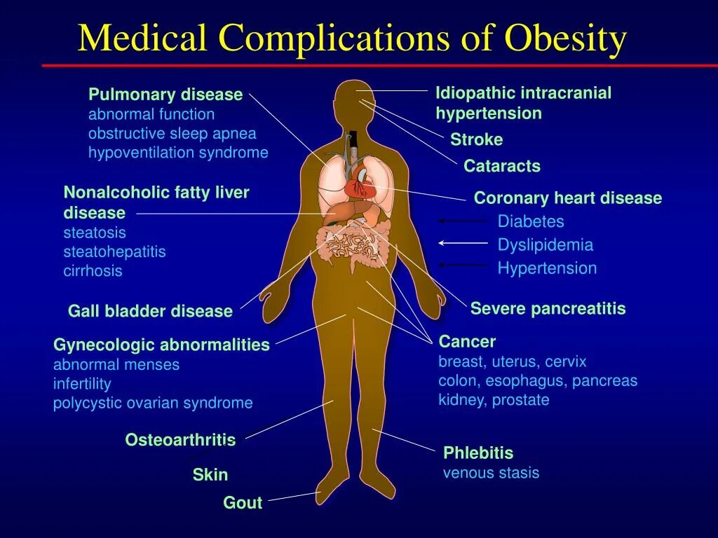 Complications of obesity. Obesity diseases. Obesity Health problem. Diseases associated