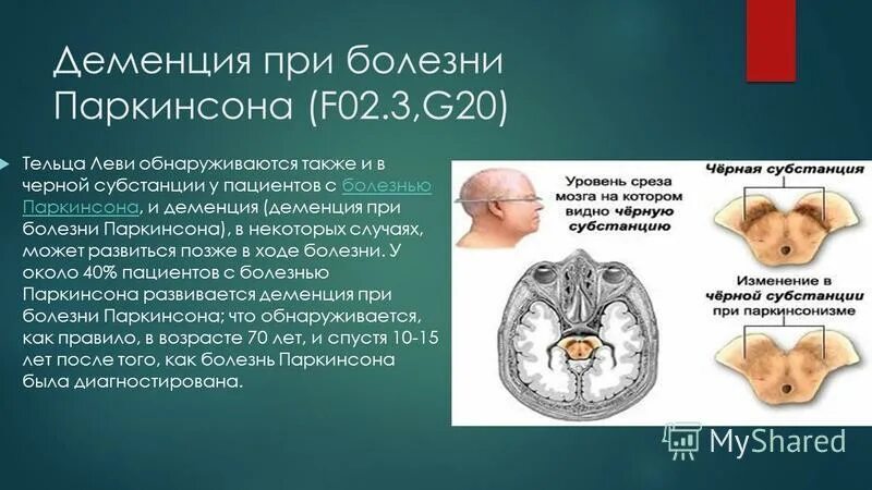 Деменция барнаул. Болезнь Паркинсона черная субстанция. Паркинсон деменция. Деменция при болезни Паркинсона. Черная субстанция при болезни Паркинсона.