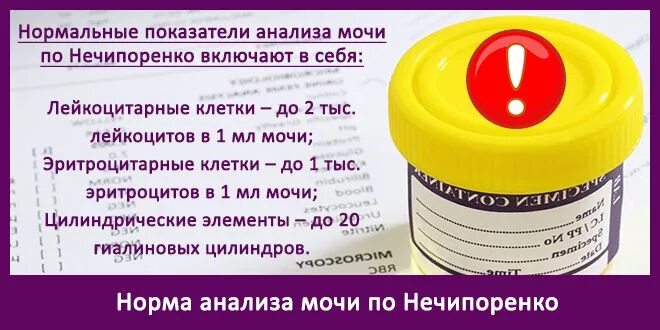 Как сдавать мочу на анализ мужчине. Сбор мочи по Нечипоренко емкость. Для исследования по Нечипоренко мочу собирают. Анализ мочи по Нечипоренко. Сбор мочи для исследования по Нечипоренко.